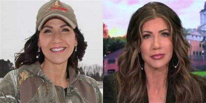 Kristi Noem Plastic Surgery: A Comprehensive Look